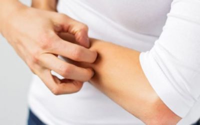 Kenapa Kulit yang Digaruk Terasa Semakin Gatal?